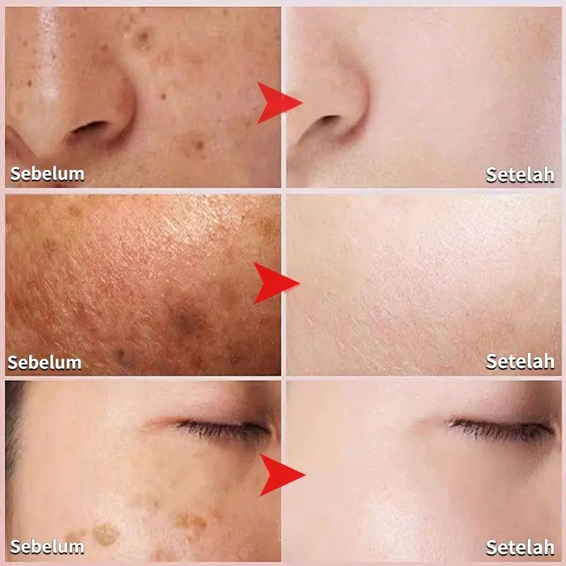 Krim penghilang flek hitam cream flek hitam membandel salep flek hitam membandel 30g menghilangkan flek hitam di wajah serum flek hitam Perawatan wajah Krim bintik Perbaikan bekas luka dan bintik bintik secara permanen dan efektif 3