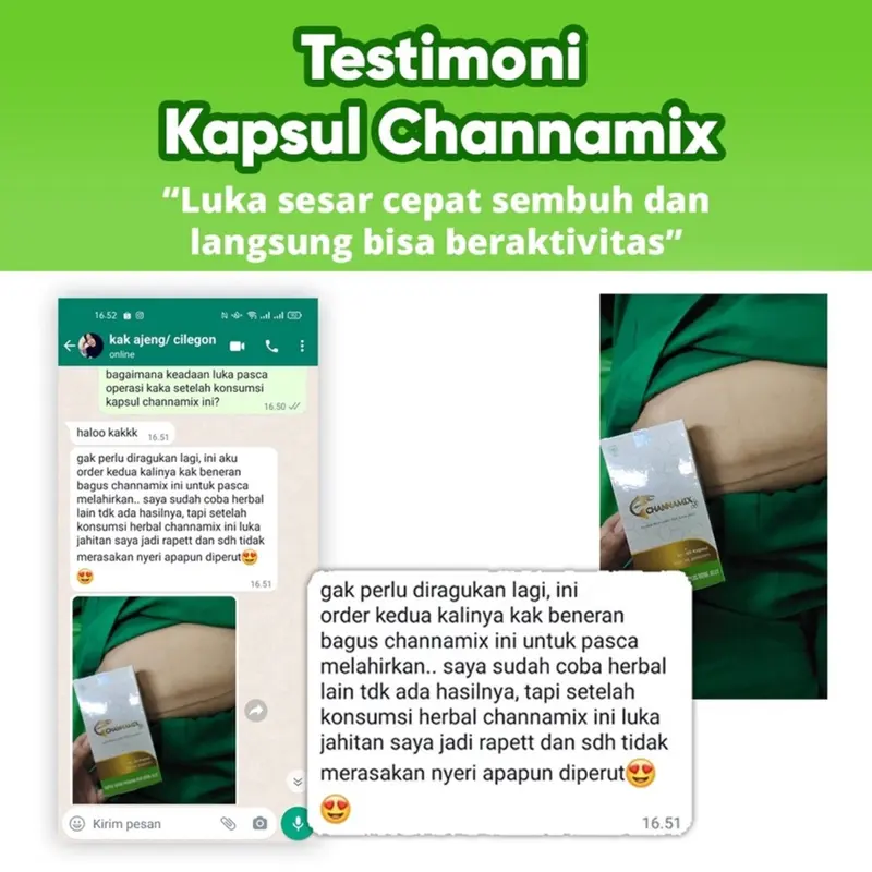 Kapsul Channamix Sari Kutuk Albumin Dan Royal Jely 4