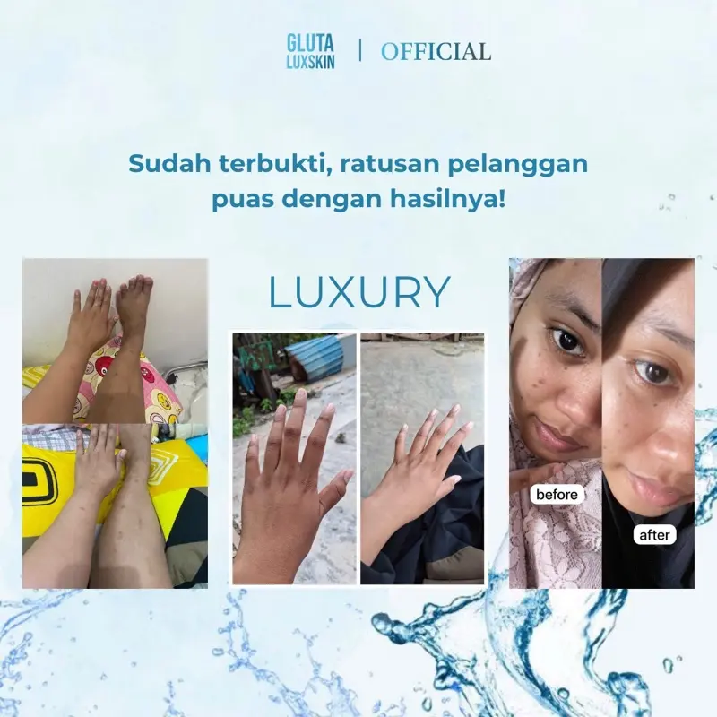 manfaat glutathione untuk kulit Gluta Luxskin Luxury (2Botol) - Perawatan Kulit Dari Dalam Dengan 98% L- Glutathione Reduced & 2% Glycine Max BPOM Halal Mencerahkan - Shop