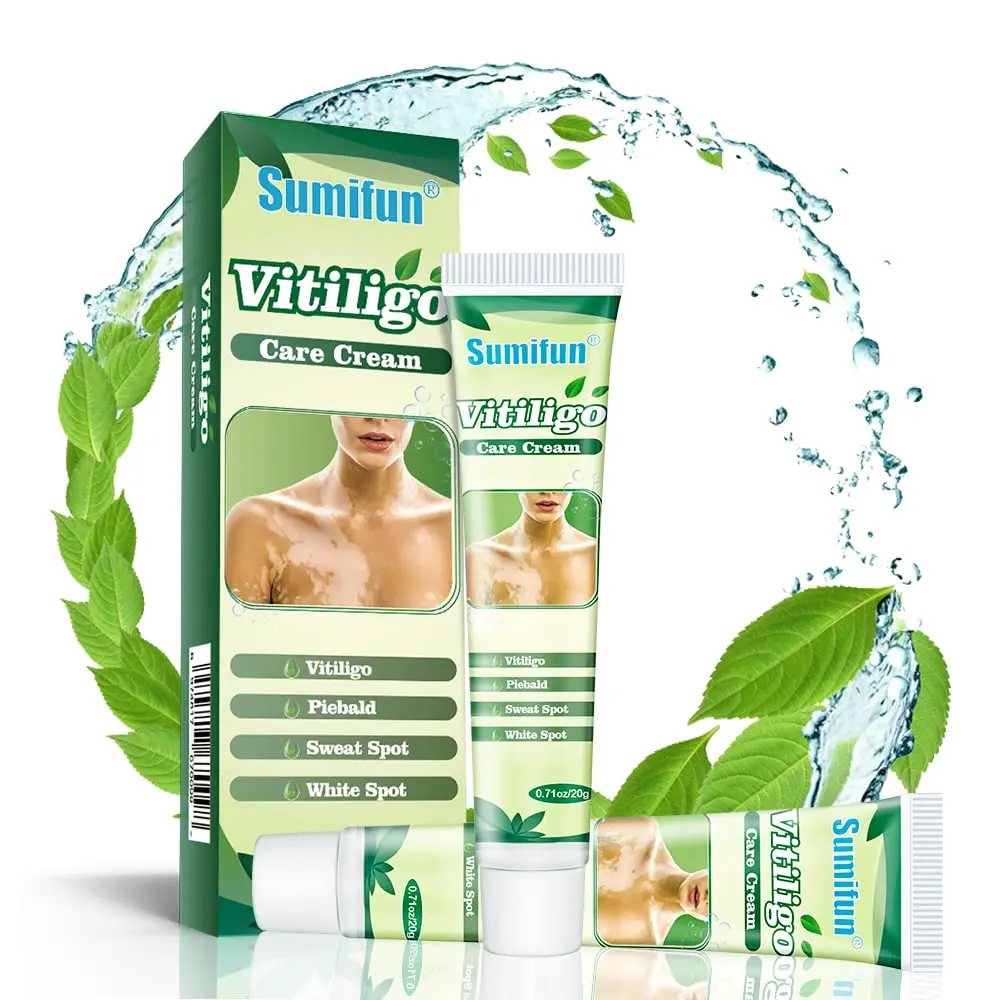 Vitiligo Cream Herbal Original Penghilang Kulit Bercak Putih pigmen putih