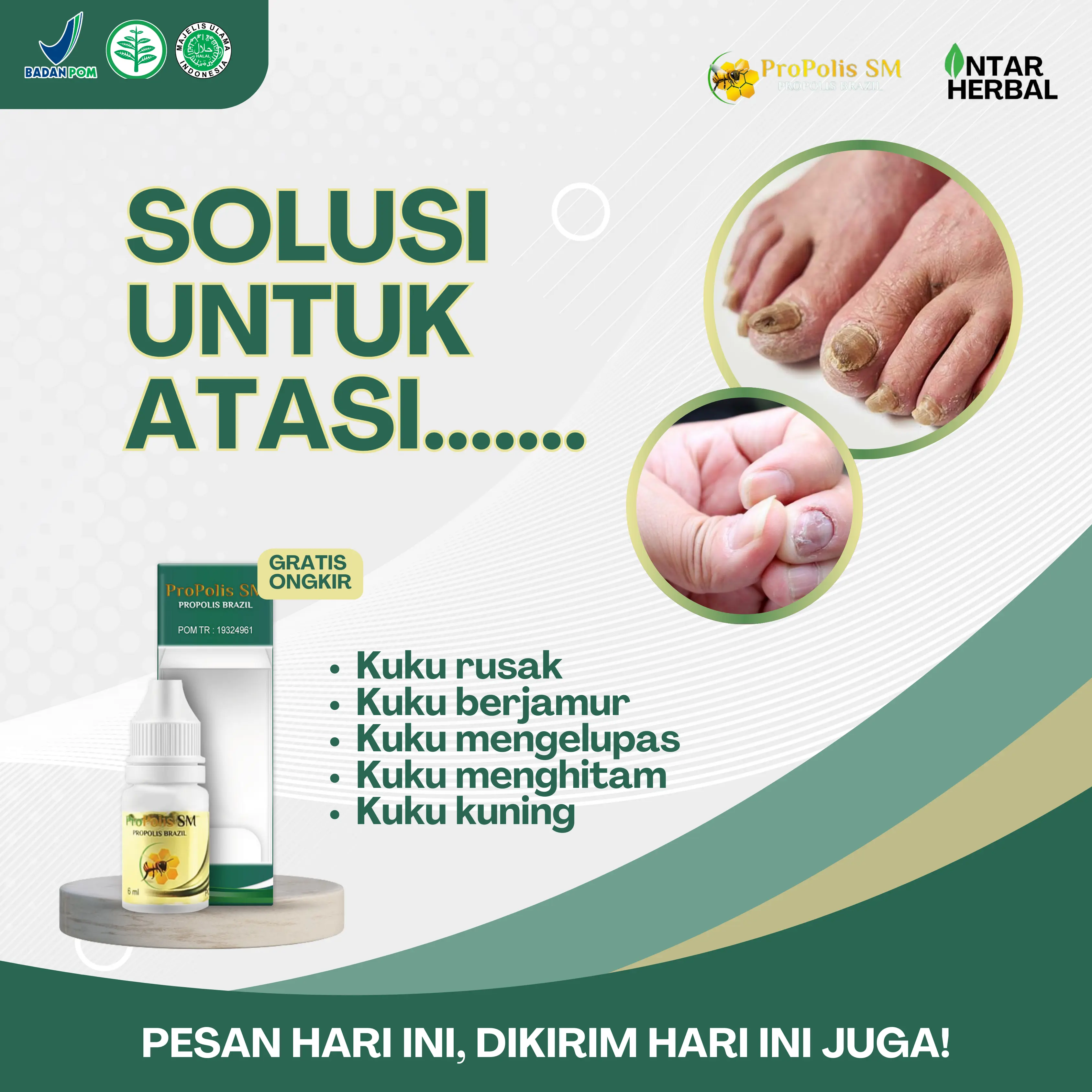 Propolis SM Untuk Jamur Kuku, Penghilang Jamur Kuku, Kuku Berjamur, Psoriasis Kuku, Pembersih Kuku Rusak, Kuku Hitam Kuning, Vitamin Kuku Kaki Dan Tangan Nail Kering