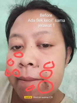 Product Review of SIMPLE PREMIUM SET - Paket Pencerah Wajah from G**i 0