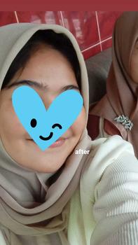 Product Review of (GET 2 PCS) Sabun Glasskin Glow Bar Soap by The Falsya Beauty Pencerah Membersihkan Memudarkan Kotoran Kulit Hitam dan Kusam Perawatan Mencerahkan Punggung Tangan from 𝔃**𐙚 1