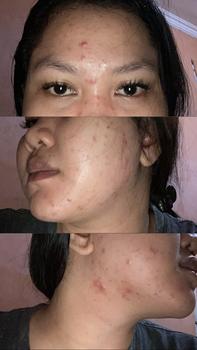 Product Review of READY SIAP KIRIM PAKET LENGKAP CREAM PEMUTIH BRIGHTENING BOOSTER LS SKINCARE Kulit sensitif Pemutihan Semua Jenis Kulit Bebas Alkohol Kontrol Minyak Hidrasi from 1** 1