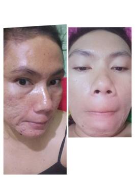 Product Review of Facial Wash Premium Marvelous Vitamin from n**k 1