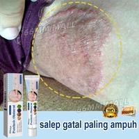 Gambar obat gatal gatal 20g salep gatal eksim paling ampuh psoriasis cream salep jamur selangkangan wanita selangkangan hitam dan gatal salep panu ampuh cepat hilang obat kadas kurap - 1 batang (20g) dari KRVELLA Kab. Bogor 1 Tokopedia
