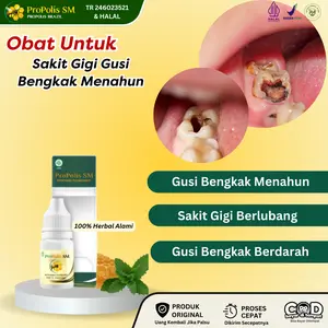 Propolis SM Untuk Sakit Gigi, Gusi Bengkak, Gigi Berlubang, Pereda Sakit Gigi Menahun, Gusi Berdarah, Sakit Gigi Nyut Nyutan Mulut Bau