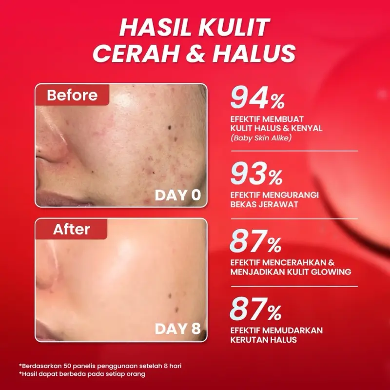Hanasui Advance Retinol Serum/ Retinol Pemula/ Hanasui serum  Wajah 6