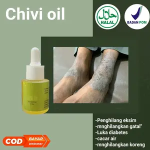 CHIVI OIL PENGHILANG GATAL EKSIM DAN JAMUR BPOM