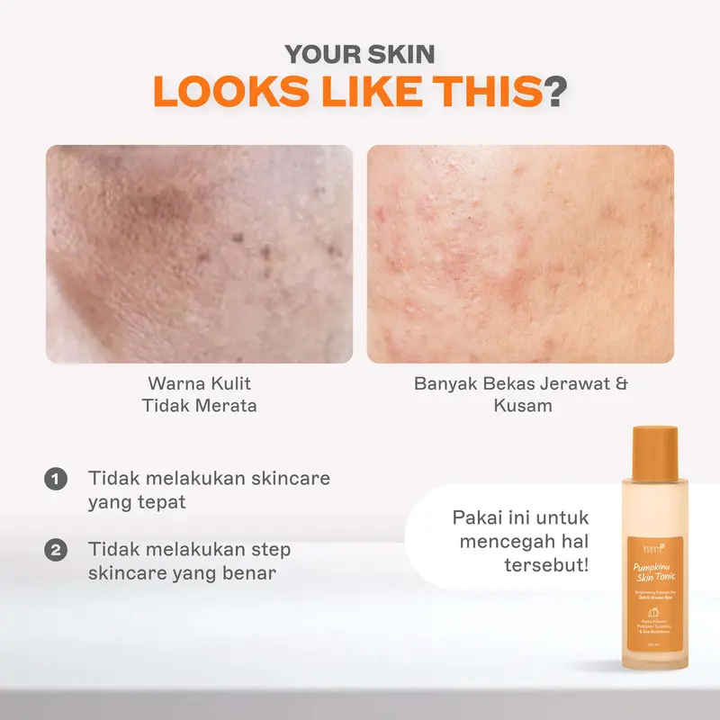 STUDIO TROPIK Pumpkinu Skin Tonic - Toner untuk mencerahkan/brightening kulit kusam | Flek hitam dan bekas jerawat pudar | Mengandung Alpha Arbutin, Pumpkin Extract dan Sea Buckthorn 5