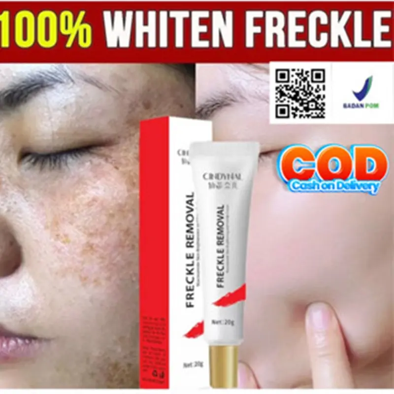 Cream Flek Hitam Membandel Yurizumi x Images 20gr - Ampuh dan Efektif untuk Bekas Luka Jerawat dan Bruntusan - Vitamin, Kering