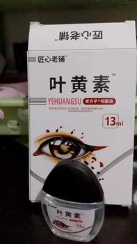 Product Review of Tetes Mata Weter On Untuk Mata Minus Katarak Glaukoma Cylinder,Buram,Sliau Softlens Lens Eye from N**l 0