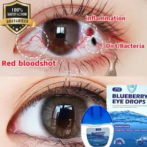 Tetes Mata Herbal Mata Kering Sakit Mata Darah Merah Ketegangan Mata - Obat Tetes Mata Obat Mata Minus 13g - Contact Lens, Eye