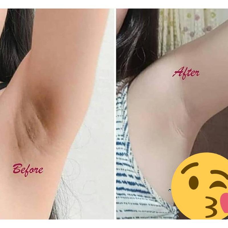 underarm whitening armpit whitening private part whitening 50g butt and inner thigh whitening cream Remove Melanin 2