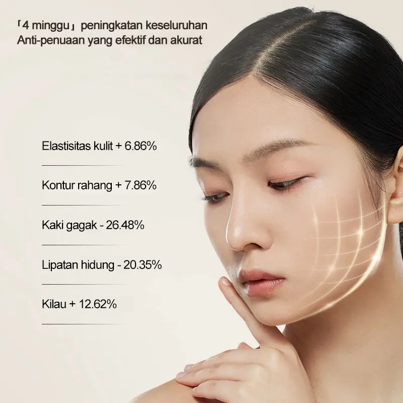 AmazeFan 4in1 setrika alat facial wajah Anti Anging alat pengecil poripori pembersih komedo wajah elektrik ion pijat face roller massager setrika kecantikan wajah RF/anti-kerut/Pemutihan/Pembersihan 3