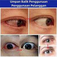 Gambar Obat tetes mata Katarak eye drop Tetes mata gatal Vitamin Mata Kesehatan Mata Obat Mata Minus Untuk Mata Buram - 1 pcs dari Cus.ID Mall Kab. Bogor 2 Tokopedia