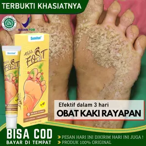 salep gatel2 paling  Obat Telapak Kaki Rayapan 20g salep gatal kulit ampuh Obat Kaki Rayapan Bolong2 Paling Kering Perawatan
