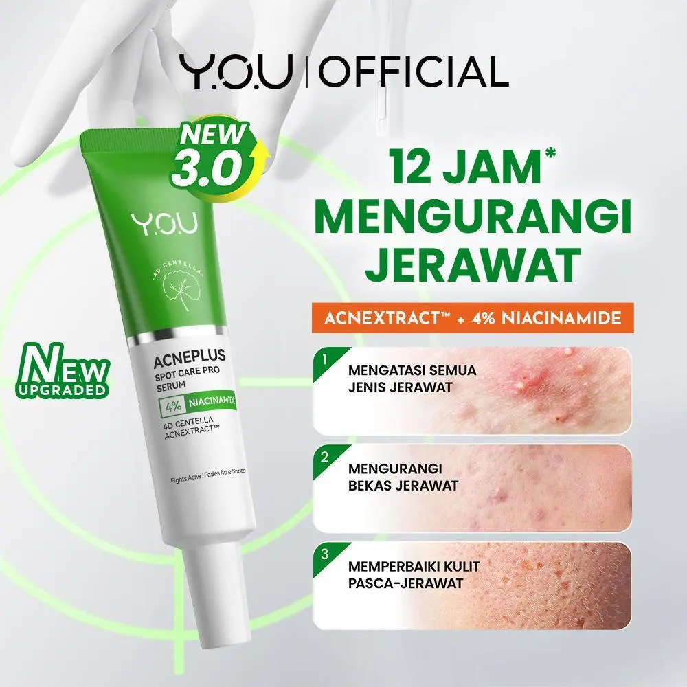 [BEST PRICE] YOU AcnePlus Spot Care Pro Serum Obat Totol Jerawat Obat Jerawat Obat Bekas Jerawat Acid Wajah Acne Spot Treatment Totol Wajah Berjerawat 24 jam Memudarkan bat Jerawat Obat Bekas Jerawat Acid Wajah Acne Spot
