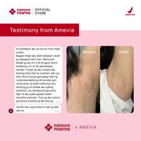 Gambar Bundling Stretch Mark & Intimate Health | Membantu Perawatan Lengkap dari Ujung Kepala hingga Ujung Kaki serta Area Kewanitaan - Regular dari Filmore Pharma Kota Bekasi 4 Tokopedia