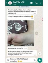 Gambar Propolis SM Obat Rayapan Kaki Bau - 6ml - Foot, Gatal Perawatan dari HerbalZen Kota Administrasi Jakarta Pusat 3 Tokopedia