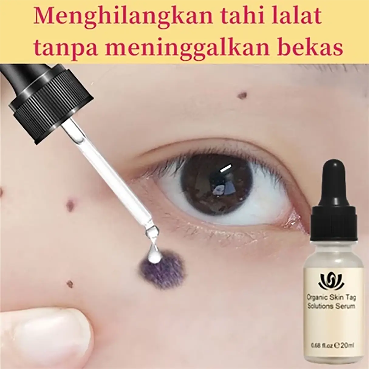 Penghilang Tahi Lalat Penghilang Kutil Penghilang Tahi Lalat Di Wajah Obat Penghilang Tahi Lalat Skin Tag Remover Tahi Lalat Menghilangkan Tahi Lalat Tanpa Luka Serum Flek Dan Bintik Menghilangkan Perbaikan Flek Hitam Memudarkan Flek Memutihkan Tanpa Beka