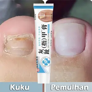 Nail Repair Cream 20g Krim Perbaikan Kuku Fungal Naml Treatment Against Nair Fungus Repair Nourishing Treatment Nail Melembutkan Tekstur Kuku Repair Nail Cracked Broken Thickening Prevent Infection Salep Jamur Kuku