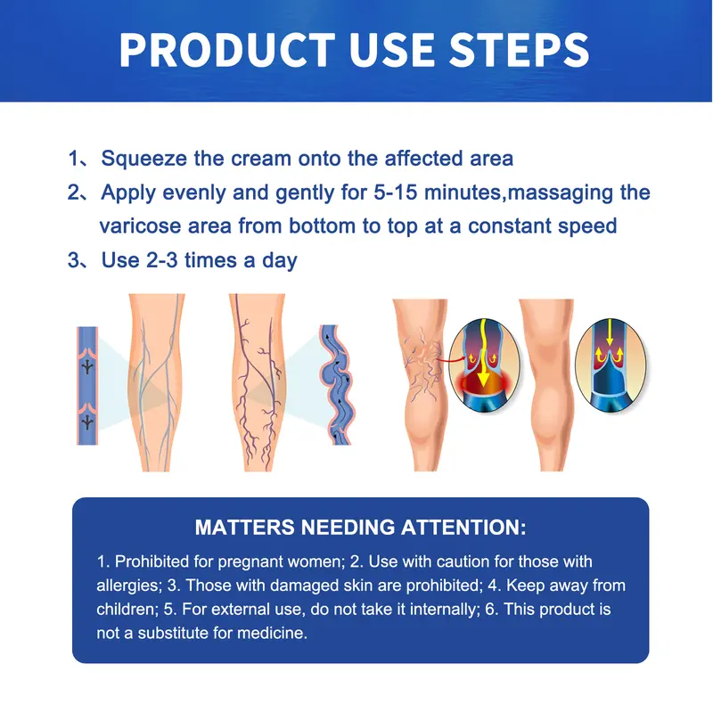 South Moon Pijat Vena Varises Krim Perbaikan Kaki Cacing Tanah Meringankan Vena Varises yang Menonjol di Kaki Extract Ceramide 4