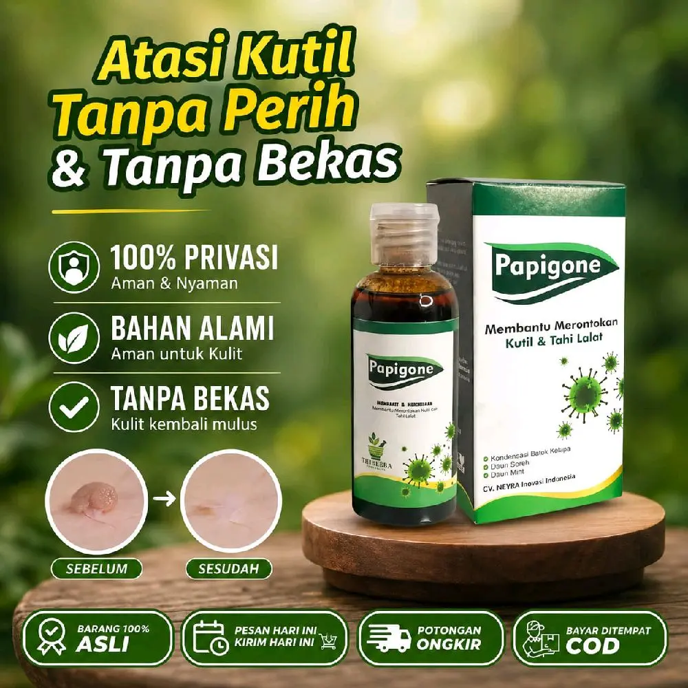 PAPIGONE Membantu Merontokan kutil dan Tahi Lalat 100% Maksimal
