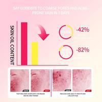 Gambar Drve salicylic acid acne serum | anti acne skincare 10ml | Membantu mengatasi kulit berjerawat kemerahan dan bekas jerawat - 1Pcs dari Drve beauty skin 6 Kab. Tangerang 5 Tokopedia