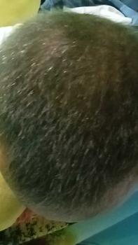 Product Review of (Promo Spesial) Aestika Dark Brown Hair Coloring Shampoo  - Pewarna Rambut Beruban Extract from d**i 0