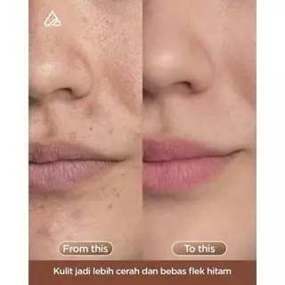 Amura Stay Young Toner - Melembabkan Mengangkat Kotoran Menyegarkan & Pembersih 8
