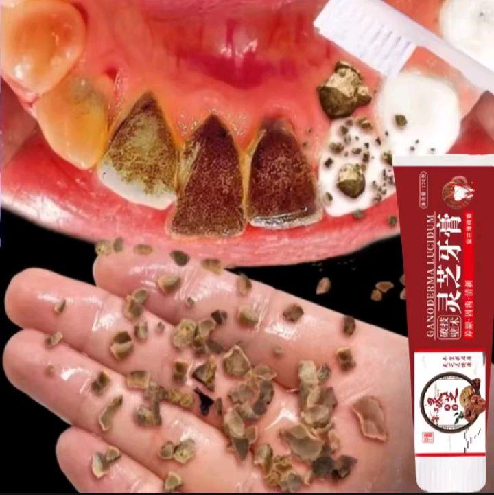 Lingzhi Toothpaste Pasta Gigi Pemutih Memutihkan Gigi Kuning Penghilang Karang Gigi Dan Pemutih Gigi Permanen 120g Odol Pembersih Karang Gigi Perawatan Pemutihan Gigi / Menghilangkan Bau Mulut/Perontok Karang Gigi/ Noda Asap / Menghilangkan Noda Teh 1