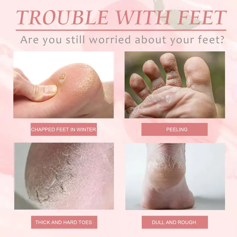 Peach Foot Mask Foot moisturizing and hydrating smooth, tender skin, anti-cracking, dead skin callus care foot mask 2