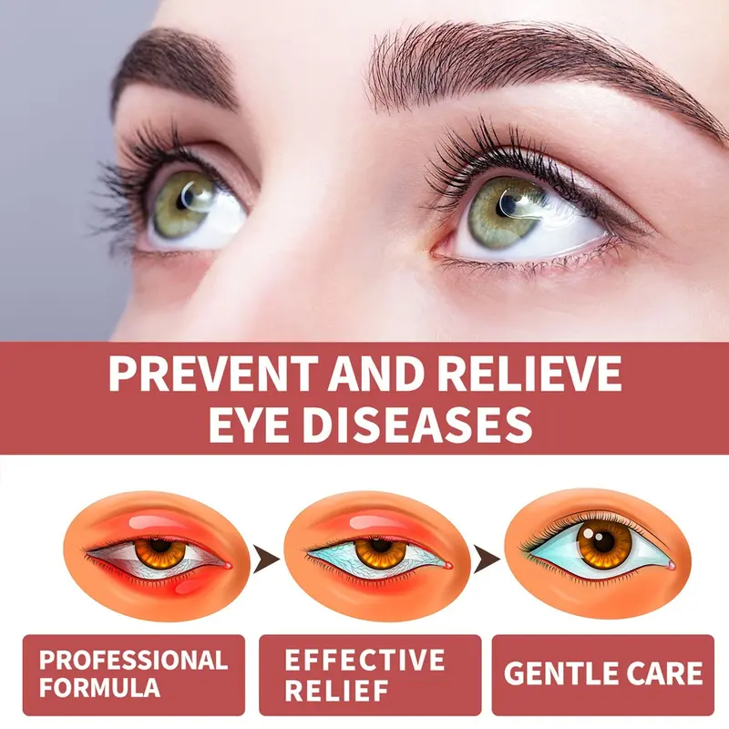 Lutein Perawatan mata Meredakan Kelelahan Mata/Tetes Mata Lutein/Mata Kering Dan Mata Astringen Presbyopia Eye Drops Relieve Eye Fatigue And Relieve Dry Eyes. 4