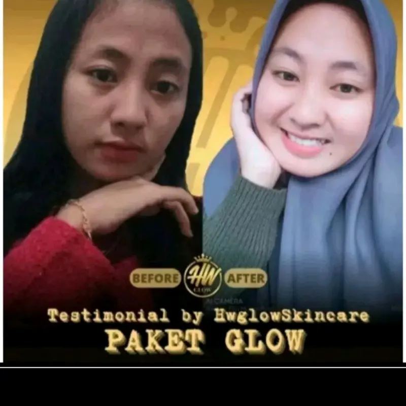 Skincare HW Glow, paket glow, 1 paket free parfum, mencerahkan dan memutihkan 3