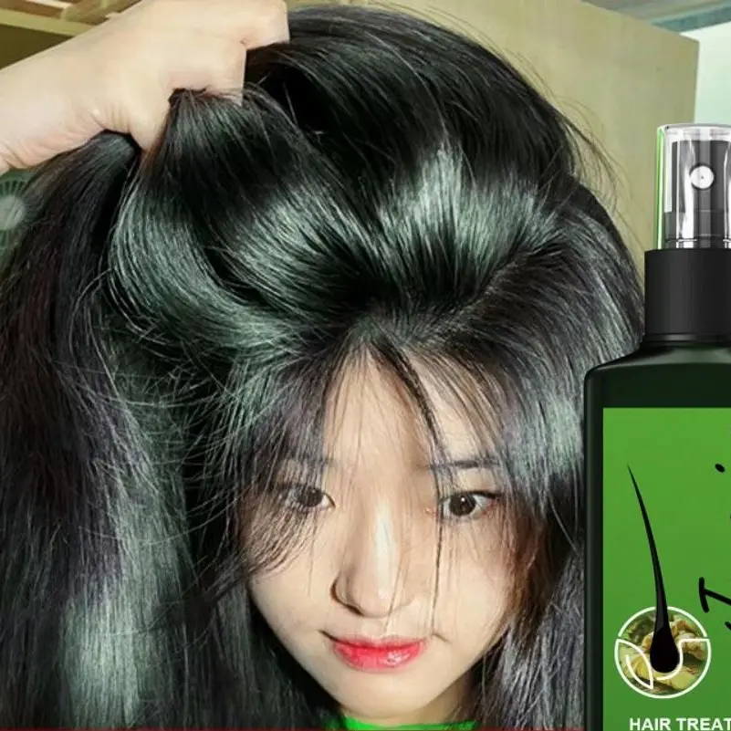 jaysuing ginger hair growth spray penumbuh rambut cepat serum penumbuh rambut botak hair tonic rambut rontok 30ml Perawatan