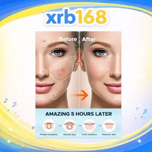 36 patches Acne Pimple Patch Hydrocolloid Invisible Acne Patch Pimple