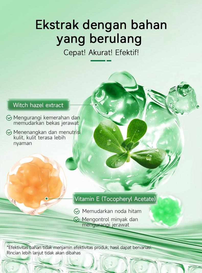 Product Introduction of （T1）BPOM.Beli 2 Gratis 1.Challenge 7 Hari Jerawat Hilang,CINSULIN Obat Jerawat Herbal Ekstrak Alami Cepat Hilangkan Komedo & Jerawat Meradang  BPOM Certified  Aman untuk Remaja & Kulit Sensitif Berjerawat Wajah Gatal Beruntusan 7