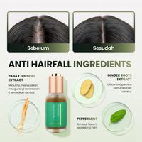 Gambar OSWEET Hair Revival Bundling | Ginger Shampoo + Tonic - Ginger 100ml + Tonic dari O'SWEET SINGAPORE Kab. Tangerang 3 Tokopedia