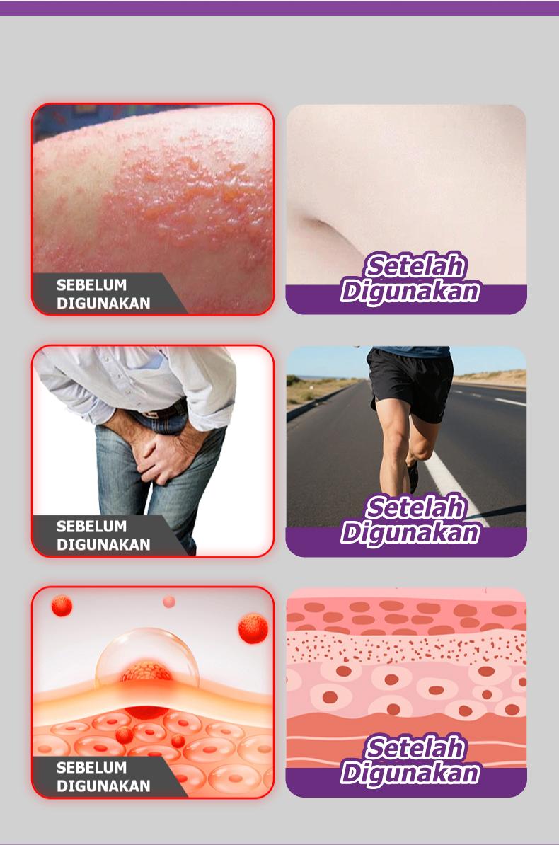 Kreain nature Skin Soothing Cream Meringankan eksim , kulit gatal, melembabkan dan melembabkan kulit