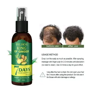 ORIGINAL 100% EELHOE KING OF GINGER 7 DAYS NUTRIENT SOLUTIONGERMINAL OIL SPRAY Haircare Perawatan Rontok Ketombe Treatment
