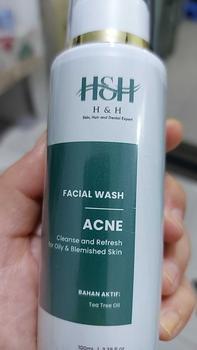 Product Review of HNH Facial Wash Acne Glow - Sabun Cuci Muka Gentle untuk Kulit Berminyak & Berjerawat from C**a 1