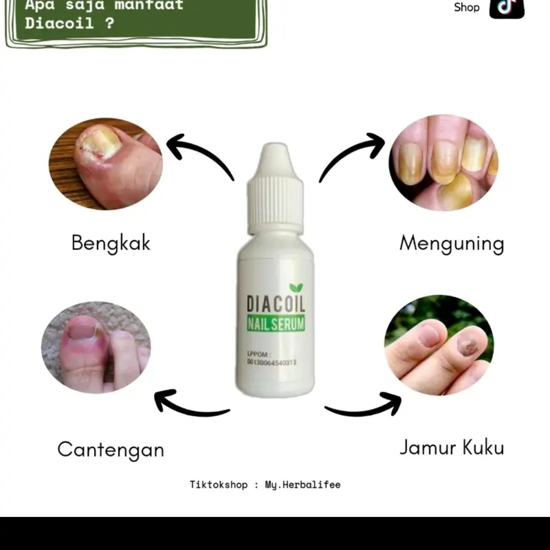 TETES KUKU CANTENGAN DIACOIL NAIL SERUM ATASI KUKU CANTENGAN 3