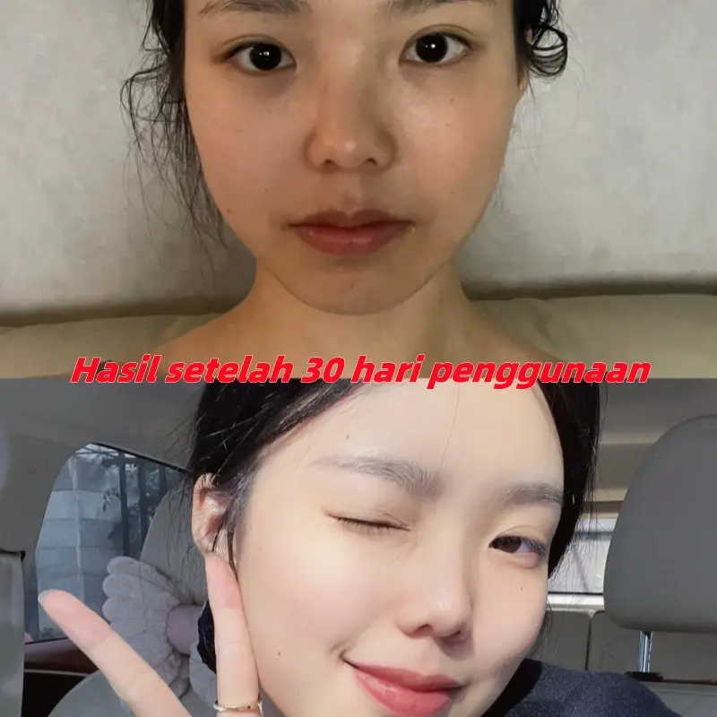 SC-II Pembersih Wajah Whitening. Kulit Halus dan Cerah, Skin&Cleaning Pembersih Wajah Niacinamide Pemutih, Dirancang Khusus untuk Kulit Kusam moisturizer  sensitif 6