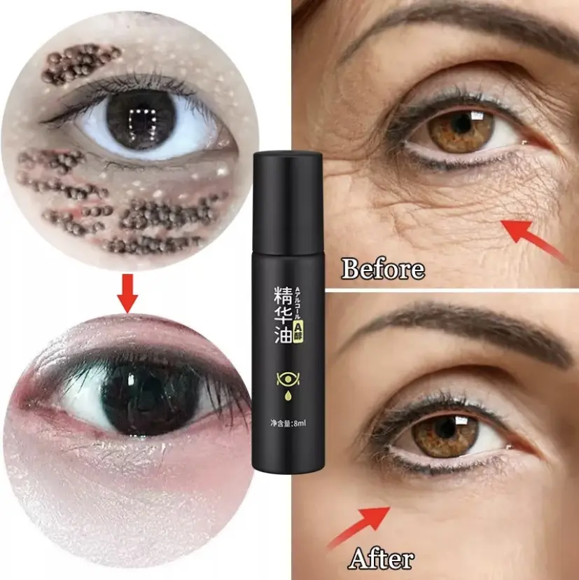 【SG LOCAL SELLER】Dr. Wen Eye Cream Hot in JapanEye Oil Anti-Wrinkle Eye Dark Circles Eye bags Eye bag remover for men blackhead remover tool Remove fat particles Effectively removes dark circles under the eyes 8ml