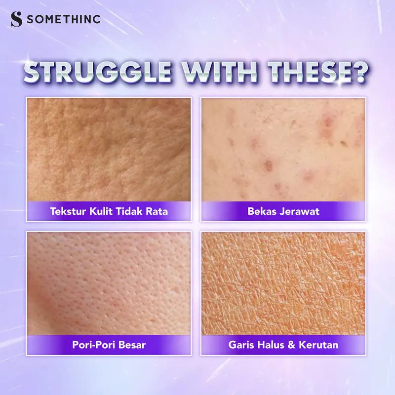 [PROMO TERBATAS] SOMETHINC SKINLIFT 1% Copper Peptide Resveratrol Serum GRATIS SERUM JARUM 4