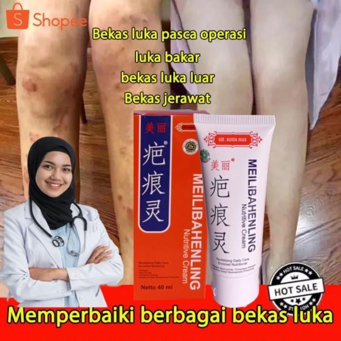 POPULER Promo penghilang bekas luka hitam koreng di kaki lama salep 1