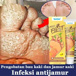 Pelembab tubuh melembabkan Obat Telapak Kaki Bolong Bau Obat Oles Kaki Rayapan Obat Penyemprot Rayapan Dan Bau Kaki Obat Kaki Bolong-Bolong Telapak Kaki Rayapan Salep Untuk Kaki Berlubang Obat Jamur di Kaki Obat Pitted Keratolysis
