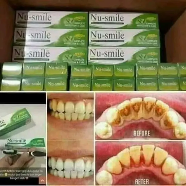 Nu Smile HWI Odol Herbal Rontokan Karang Gigi Perawatan Mulut 1