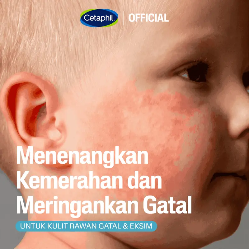 Cetaphil Pro Ad Derma Repair Cream 227g Triple Pack 1